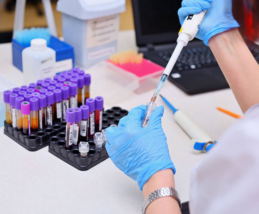 The laboratory technician with rubber gloves uses a pipette to take samples from the blood test